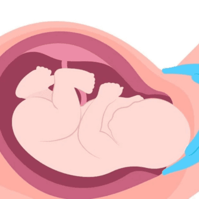 নরমাল ডেলিভারি